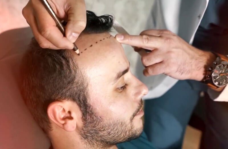 Competition among human females likely contributed to concealed ovulation